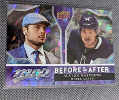 2021-22 Upper Deck MVP Before and After Auston Matthews #BA1 Maple Leafs
